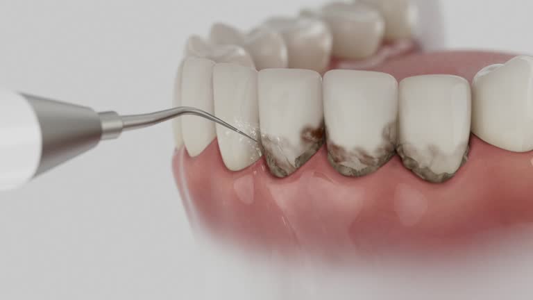 Trusted Root Canal Treatment service in Bayou Country Club, LA - Dentist Open Now